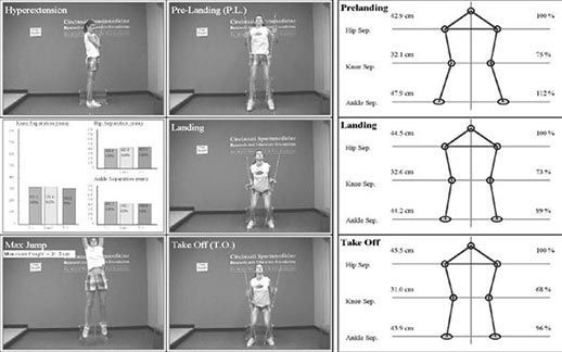 Vier visuelle Rahmen zeigen eine Figur in verschiedenen Sprungphasen: Überstreckung, vor der Landung, Landung und Absprung, mit zugehörigen Grafiken und Messwerten.